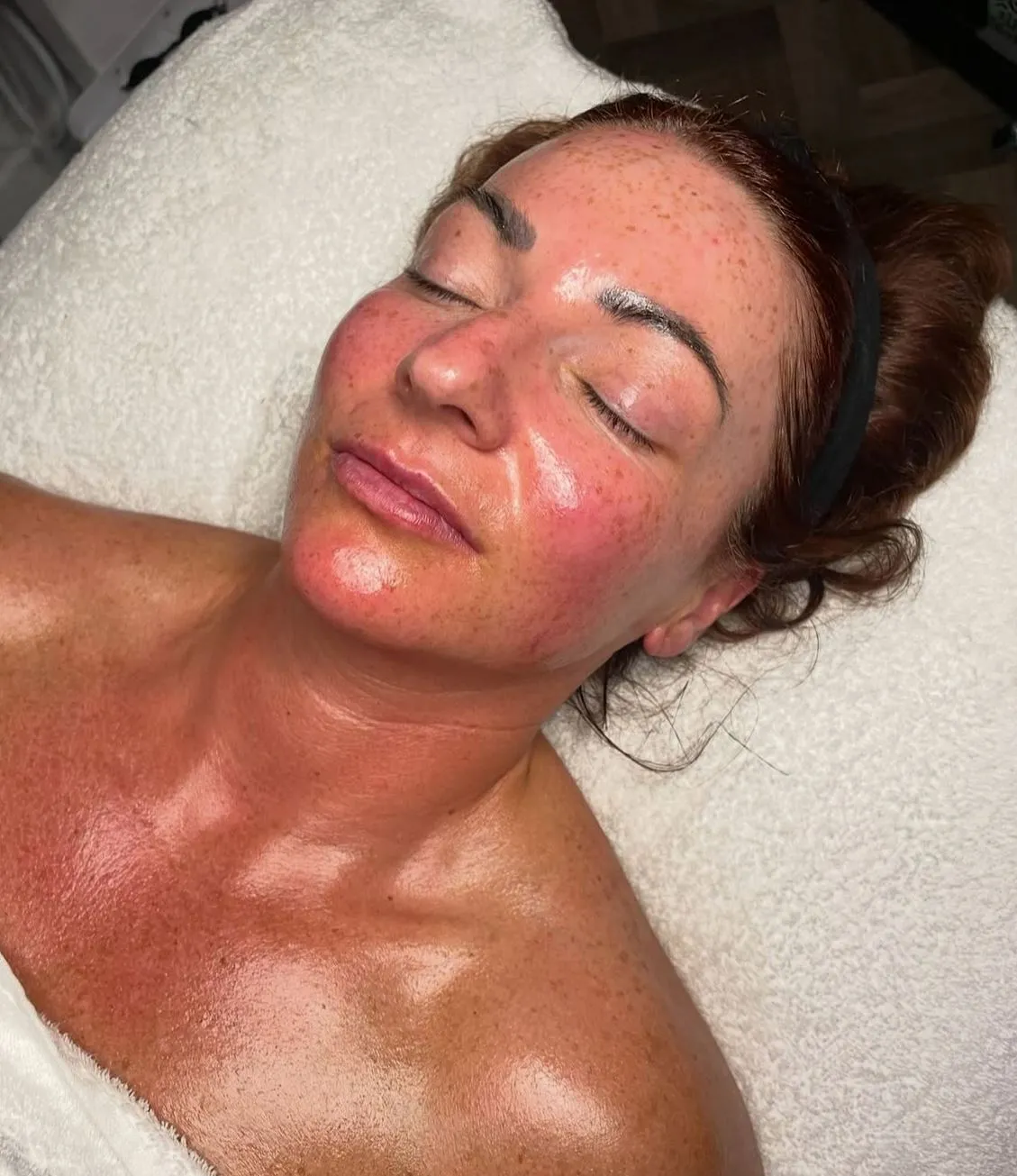 Facial Aftercare