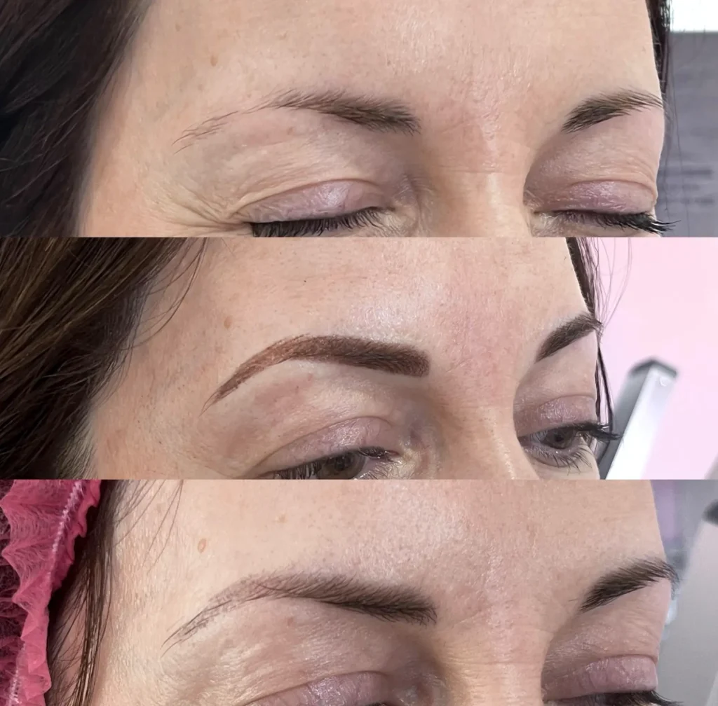 What Are the Best Alternatives to Microblading